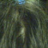 This goose egg was a real "hair raising" experience!